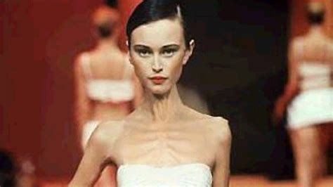 louis vuitton models too skinny|Models are supposed to be unusually thin and pretty and that's ok.